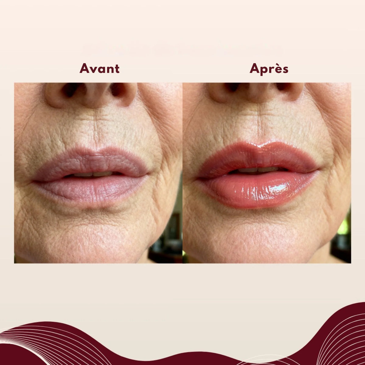 Il Ne Bave Pas Dans les Ridules Autour de Ma Bouche